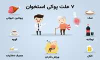 روز جهانی پوکی استخوان